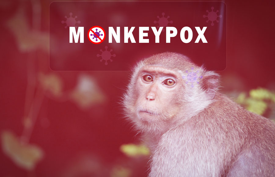 Monkeypox 