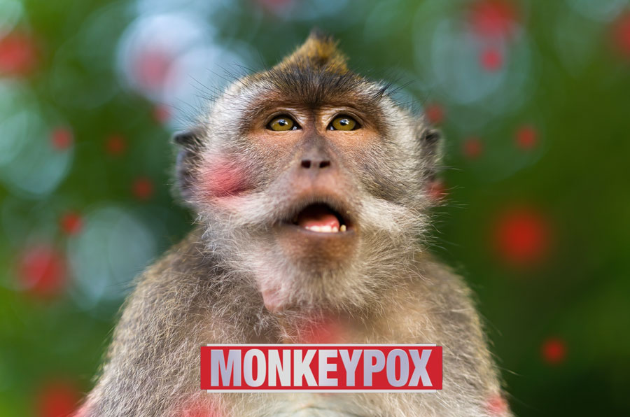 monkeypox virus genome